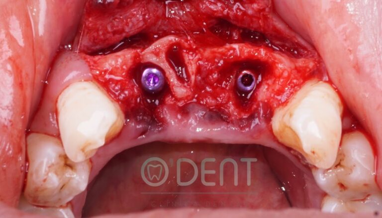 19779 odent clinica dental 768x438