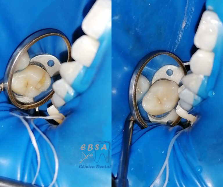 19958 ebsa dental oaxaca 768x644