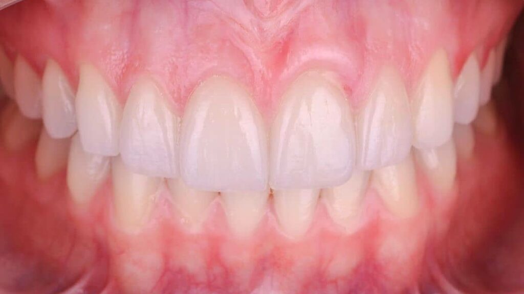 20115 dentista gustavo gaytan salim 1024x576