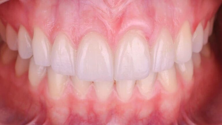 20115 dentista gustavo gaytan salim 768x432