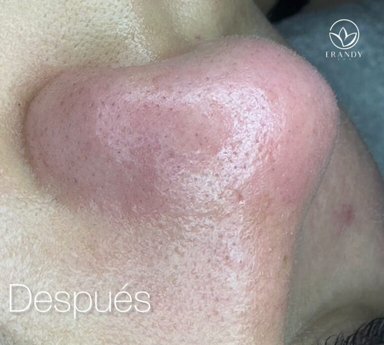 21054 erandy spa 768x690