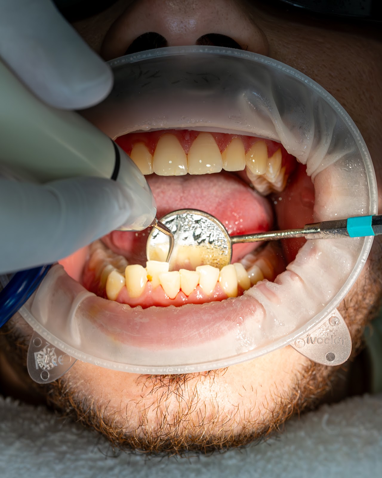 leetx-google-photo-1770166588244-2 leetx-google-photo-1770166588244-2